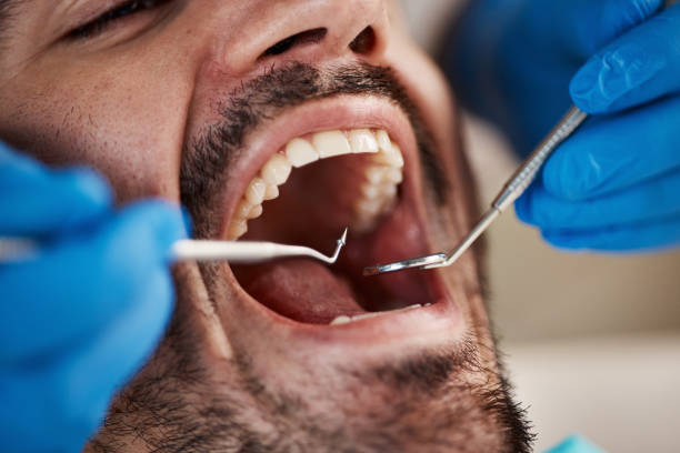Best Weekend Emergency Dentist in Kingsville, MD